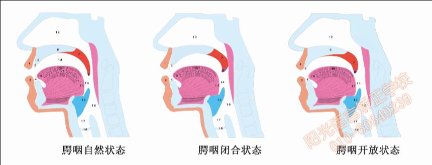 腭咽状态